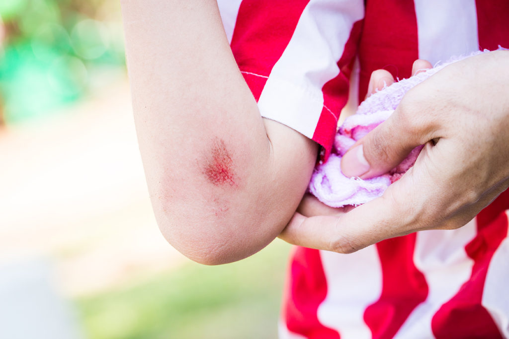 bleeding or severe bruising  in Children