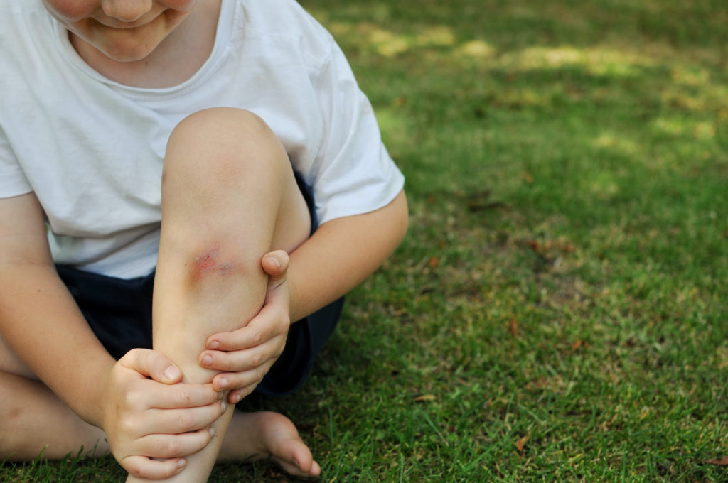 Common Causes of Bruises and Bleeding in Children