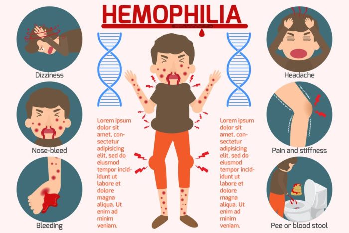 Symptoms and Signs of Hemophilia in Young Patients