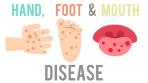 Contagious Nature of Hand-Foot-and-Mouth Disease