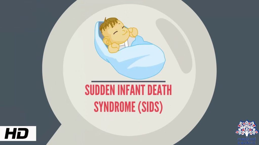 Breastfeeding and the prevention of Sudden Infant Death Syndrome (SIDS)
