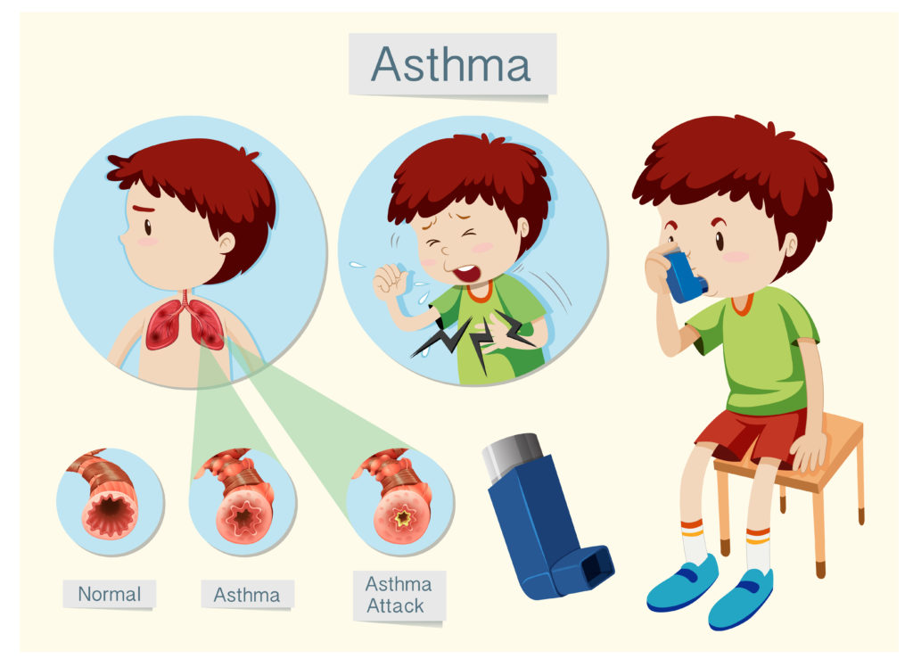 Recognizing and responding to asthma attacks